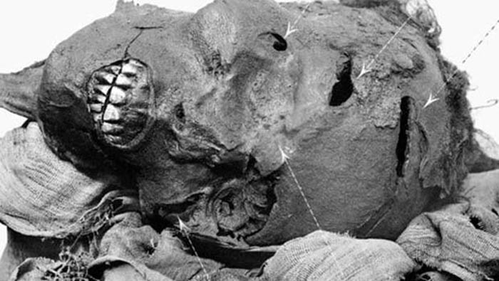 Seqenenre mummy battlewounds
